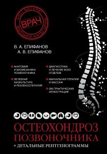 Остеохондроз позвоночника + детальные рентгенограммы