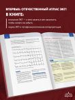 Атлас электрокардиографии. Интерпретация результатов: от простого к сложному