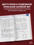 Атлас электрокардиографии. Интерпретация результатов: от простого к сложному