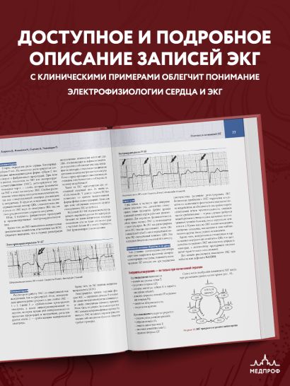 Атлас электрокардиографии. Интерпретация результатов: от простого к сложному