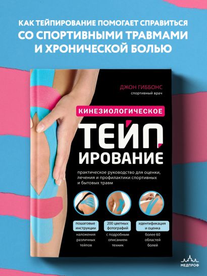 Кинезиологическое тейпирование