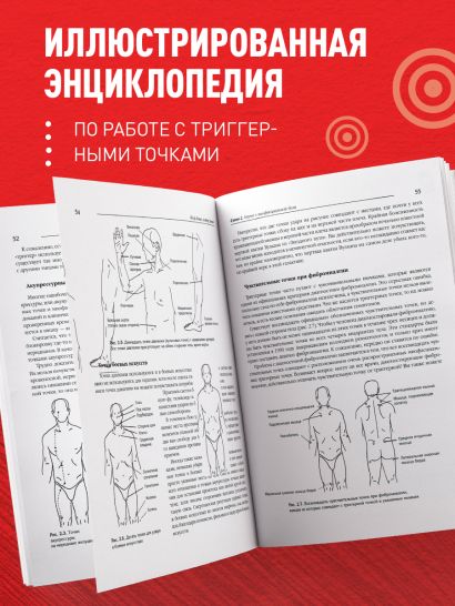 Синдром «замороженного» плеча. Терапия триггерных точек для преодоления боли и восстановления диапазона движений