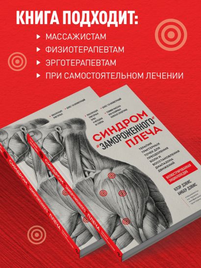 Синдром «замороженного» плеча. Терапия триггерных точек для преодоления боли и восстановления диапазона движений