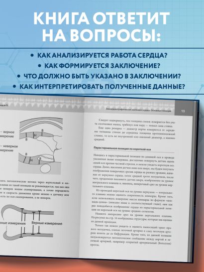 Эхокардиография для начинающих. Суть гемодинамических нарушений, позиции для анализа, определение тяжести порока