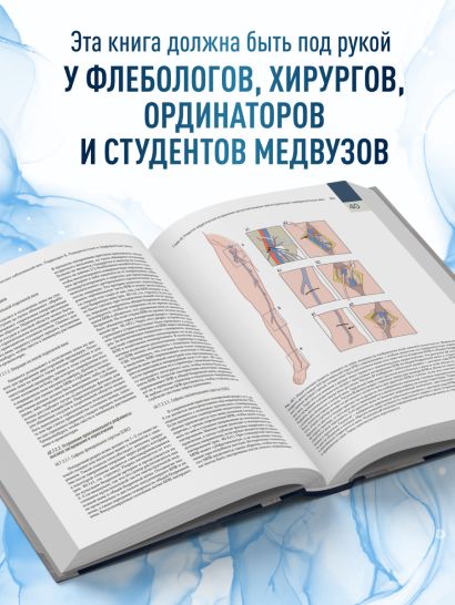 Венозные и лимфатические заболевания. Практическое руководство, 5-е издание